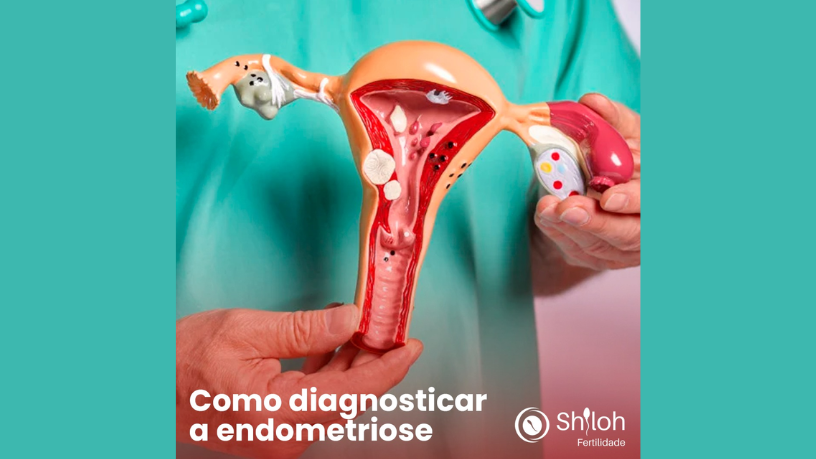 Condições tubárias como a hidrossalpinge exigem atenção: a visão de Oluwatosin Tolulope Ajidahun sobre diagnóstico e tratamento.

